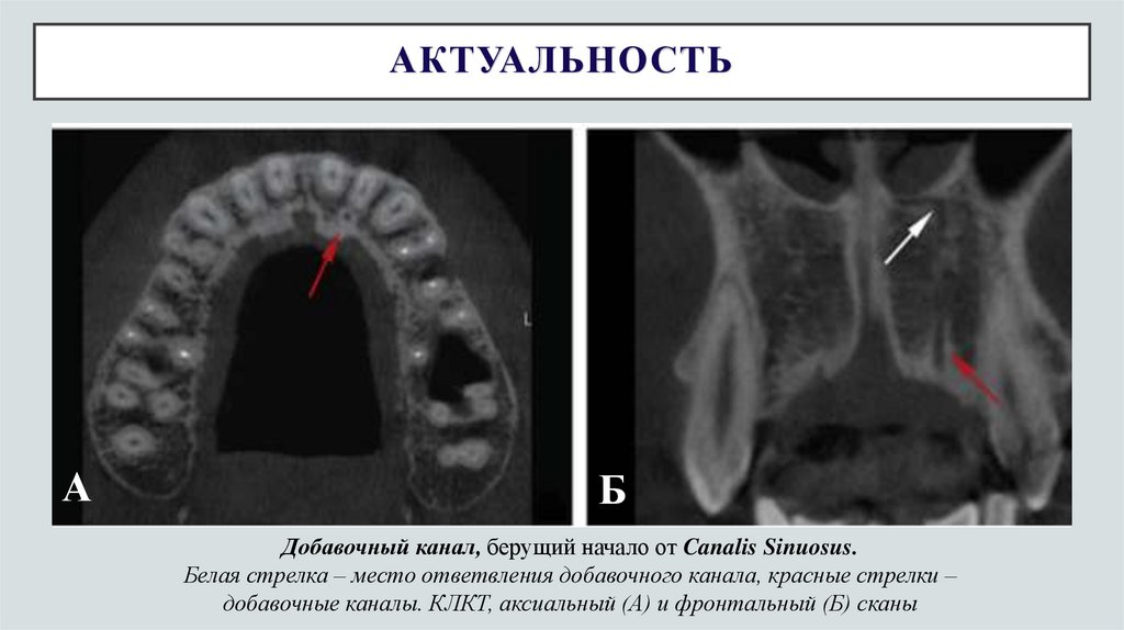 АКТУАЛЬНОСТЬ