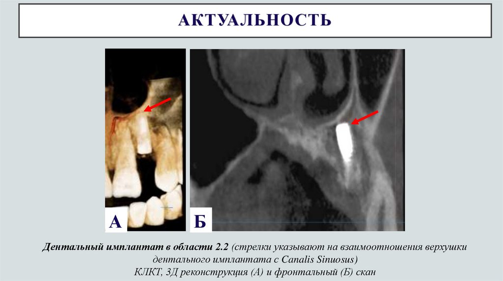 АКТУАЛЬНОСТЬ
