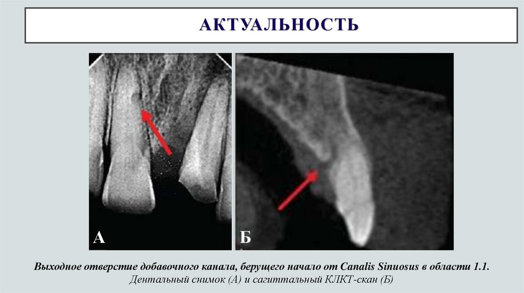 АКТУАЛЬНОСТЬ