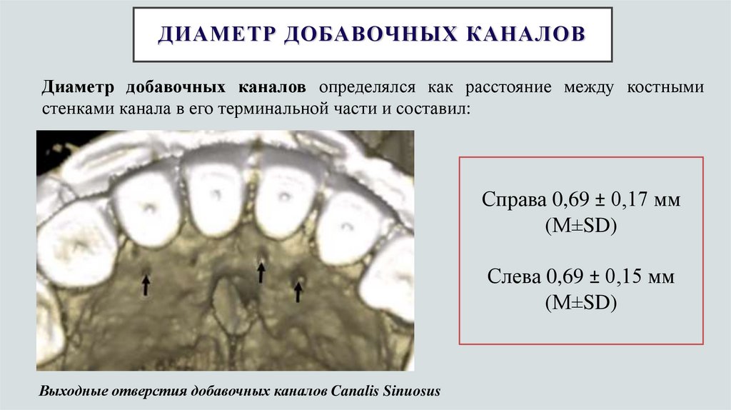 Диаметр добавочных каналов