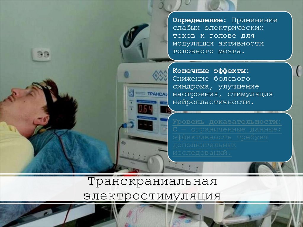 Транскраниальная электростимуляция