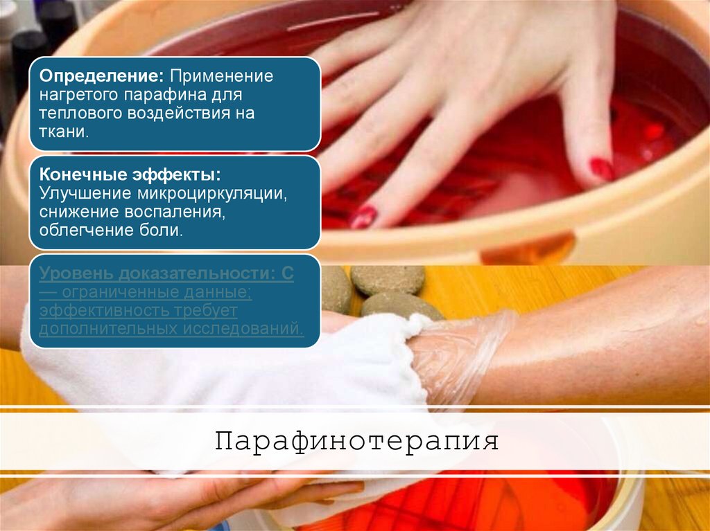 Парафинотерапия