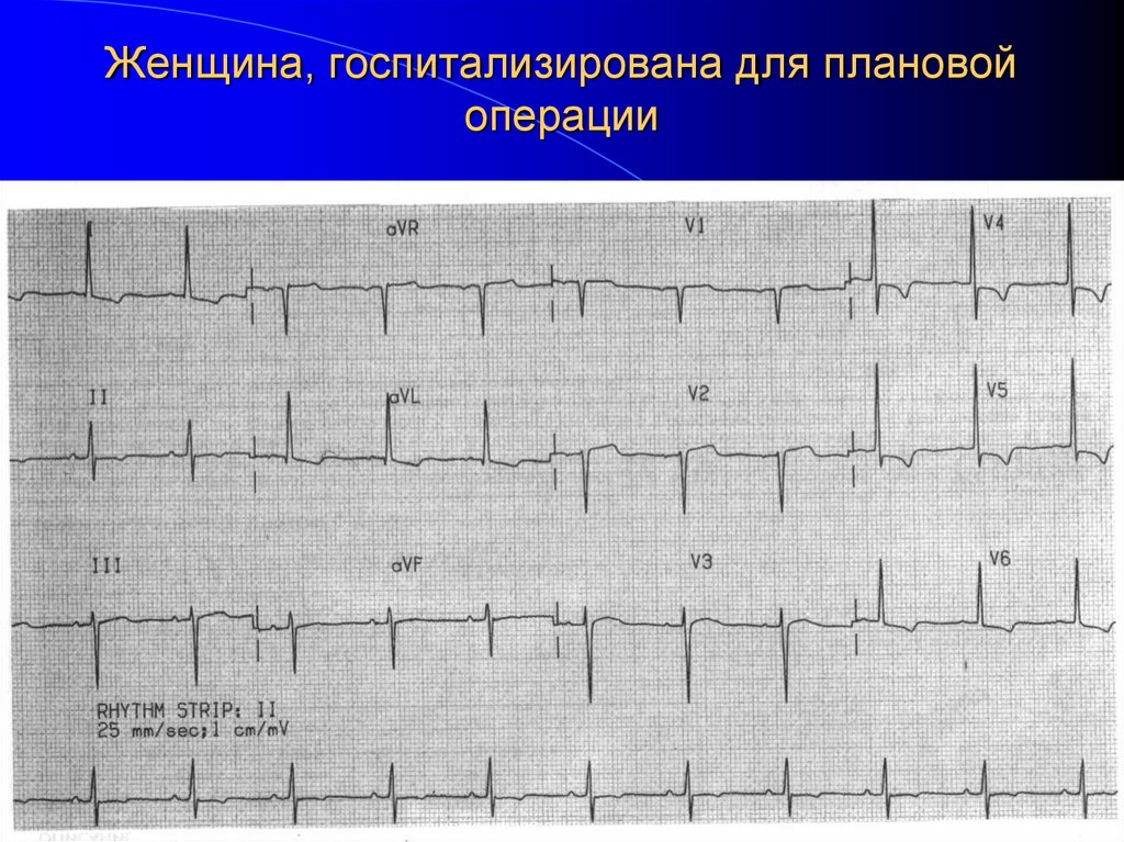Женщина, госпитализирована для плановой операции