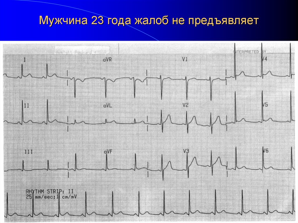 Мужчина 23 года жалоб не предъявляет