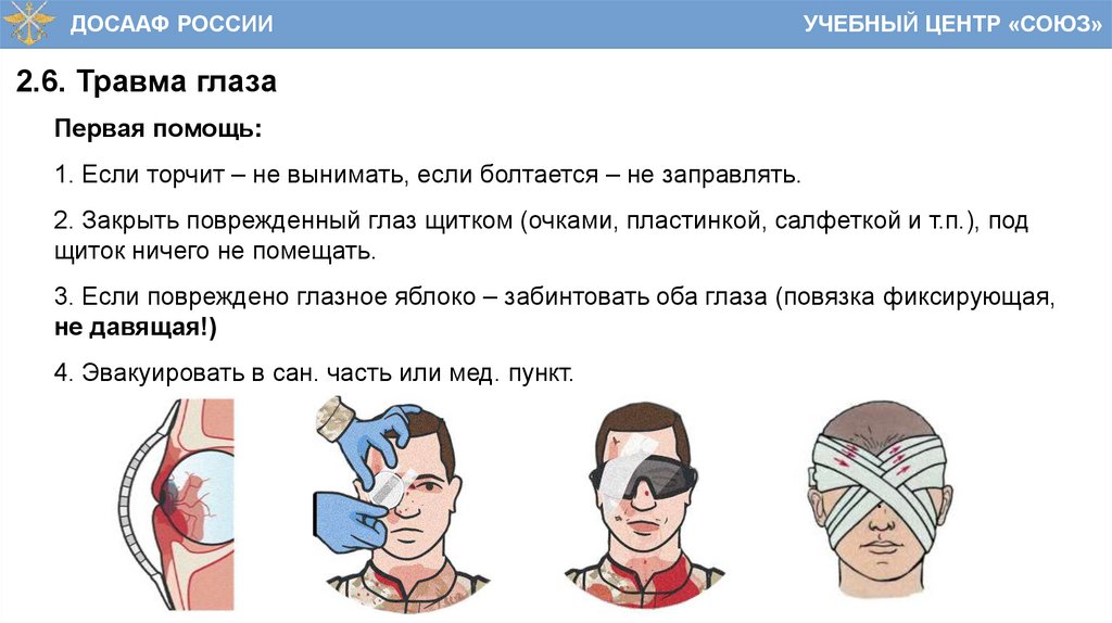 2.6. Травма глаза