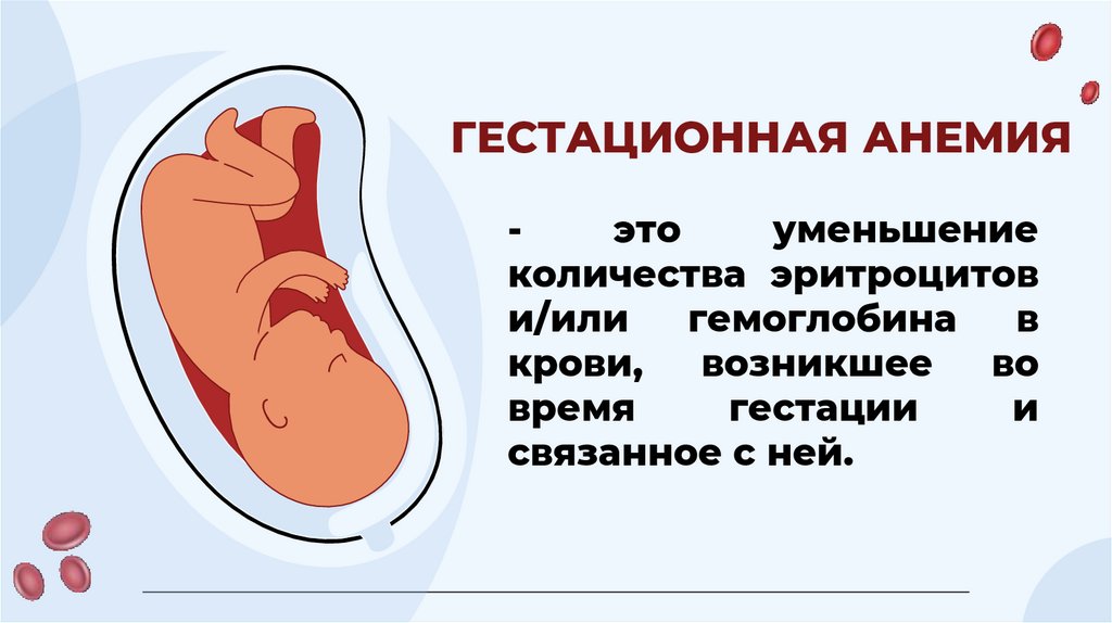 ГЕСТАЦИОННАЯ АНЕМИЯ