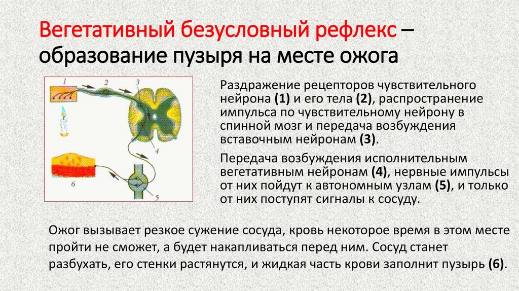 Вегетативный безусловный рефлекс – образование пузыря на месте ожога