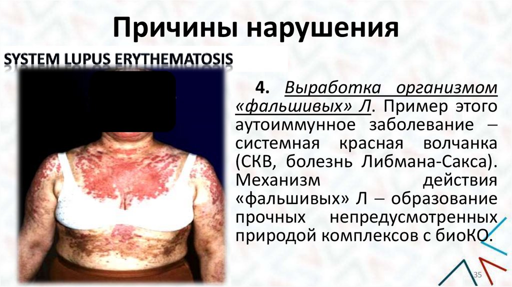 Причины нарушения