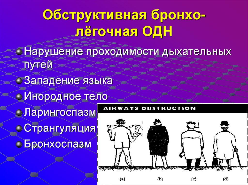Обструктивная бронхо-лёгочная ОДН