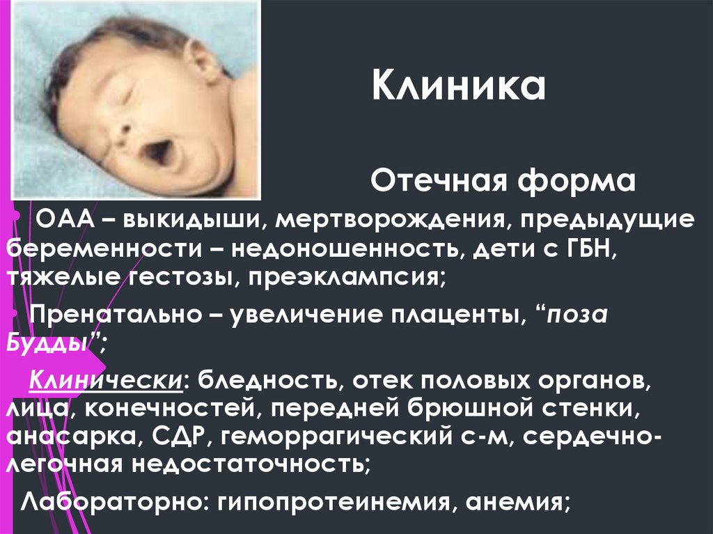 Клиника Отечная форма