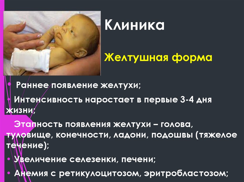 Клиника Желтушная форма
