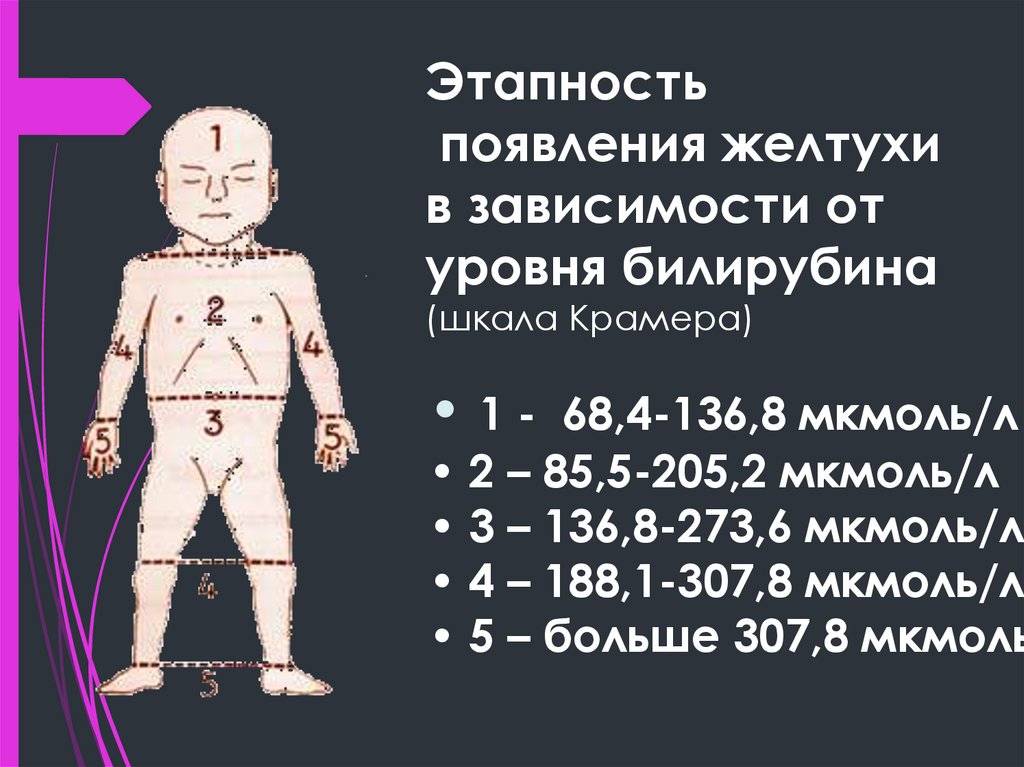 Этапность появления желтухи в зависимости от уровня билирубина (шкала Крамера)