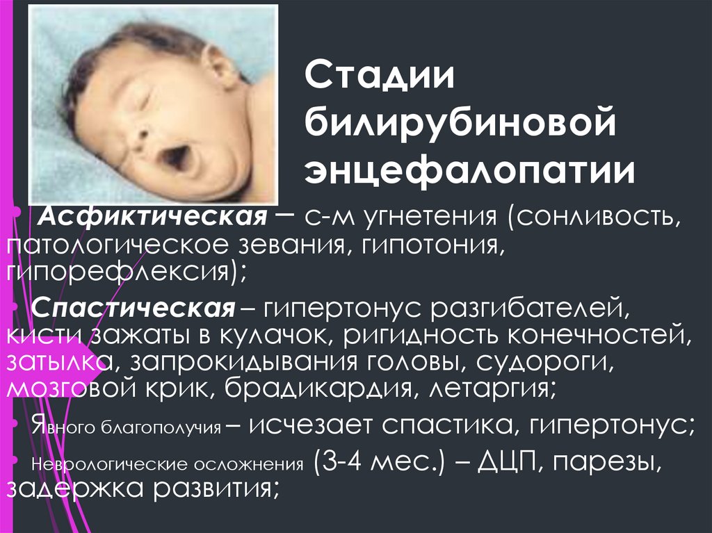 Стадии билирубиновой энцефалопатии