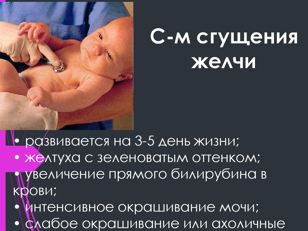 С-м сгущения желчи