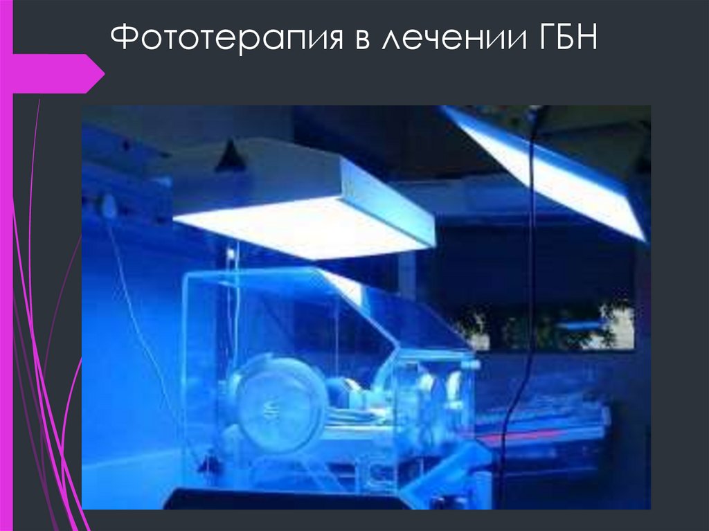 Фототерапия в лечении ГБН