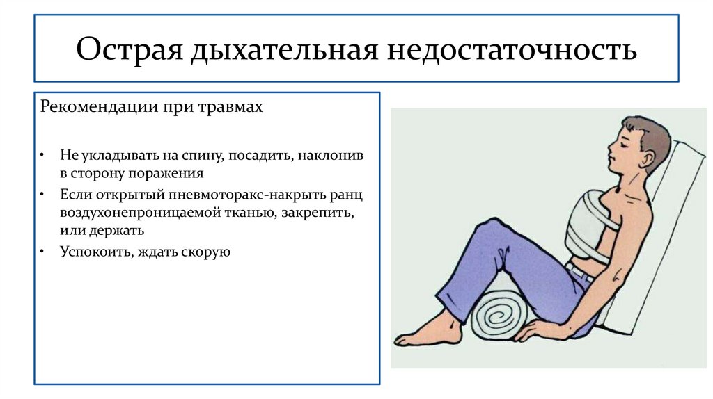 Острая дыхательная недостаточность