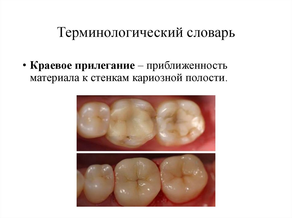 Терминологический словарь