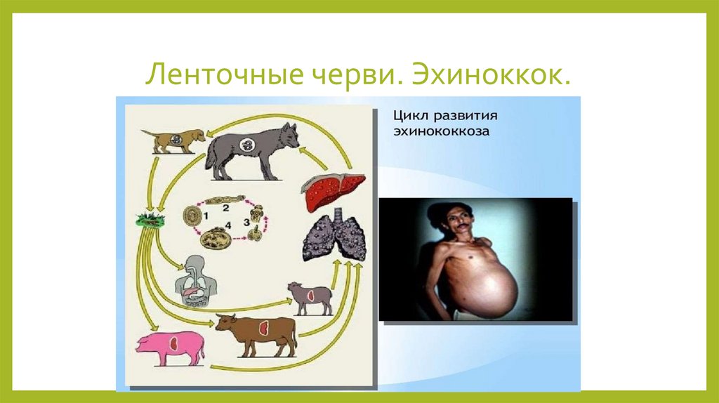 Ленточные черви. Эхиноккок.