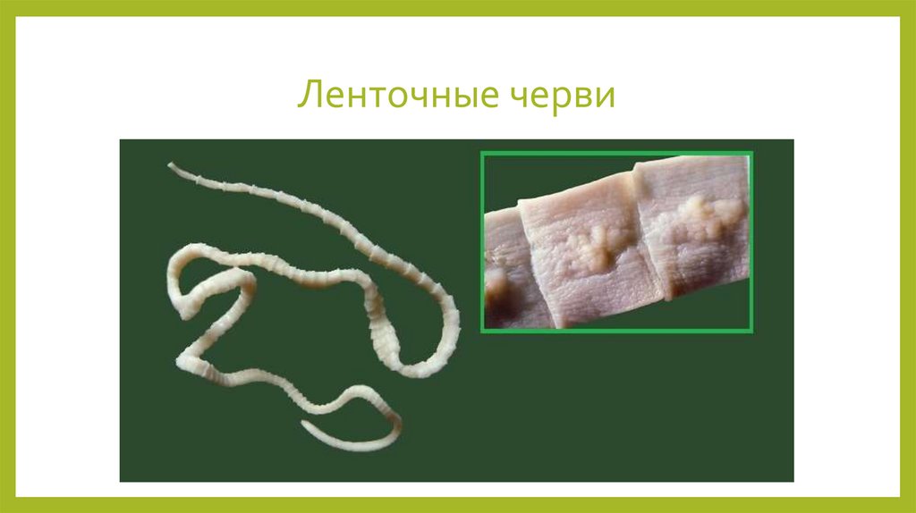 Ленточные черви