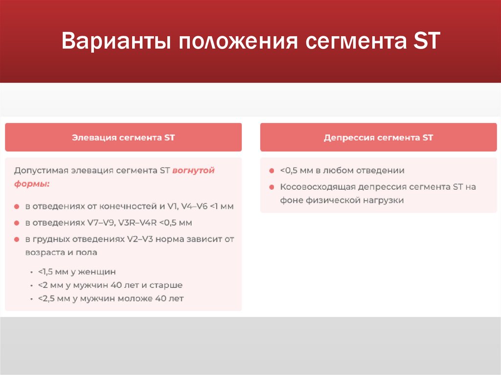 Варианты положения сегмента ST