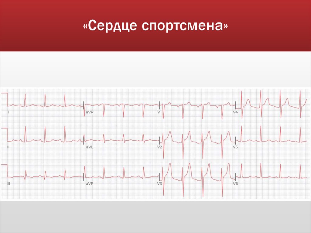«Сердце спортсмена»