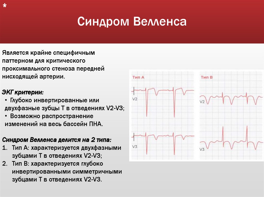 Синдром Велленса