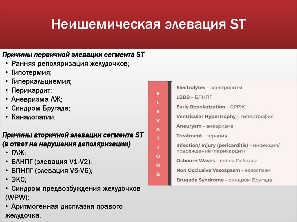 Неишемическая элевация ST