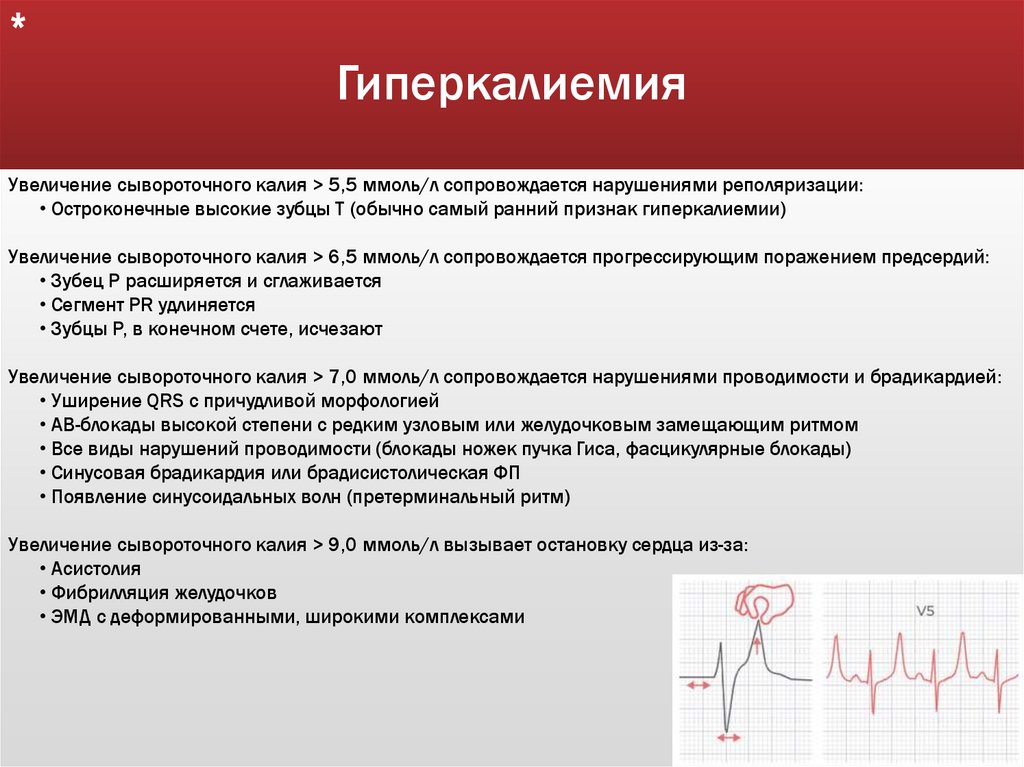 Гиперкалиемия