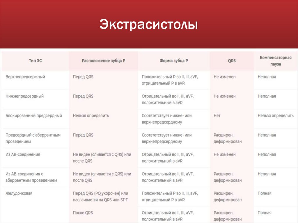 Экстрасистолы