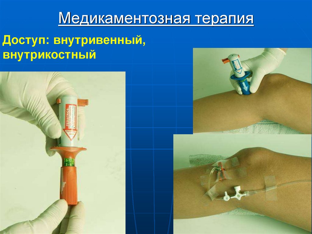 Медикаментозная терапия