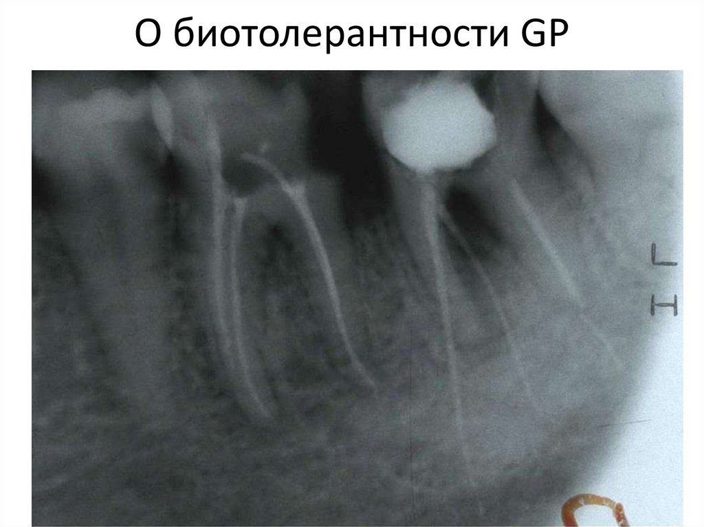 О биотолерантности GP