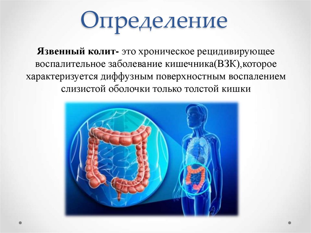 Определение