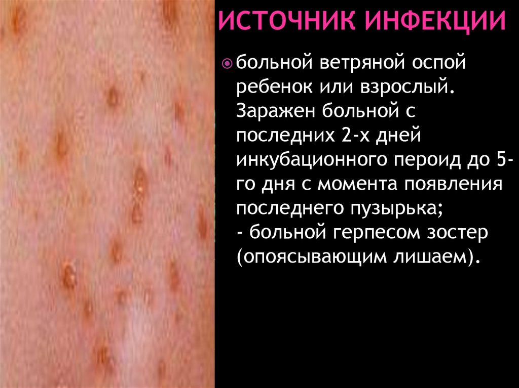 Источник инфекции