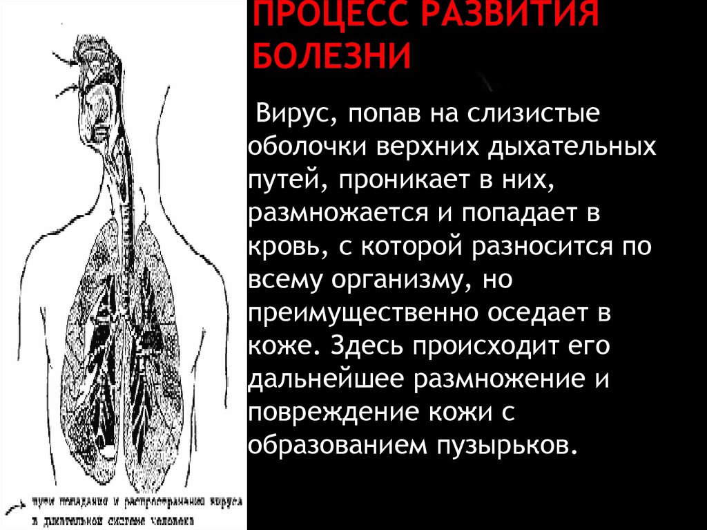 Процесс развития болезни