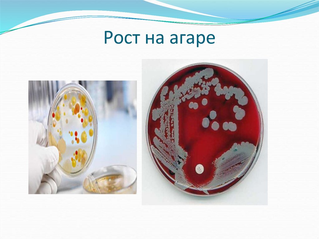 Рост на агаре