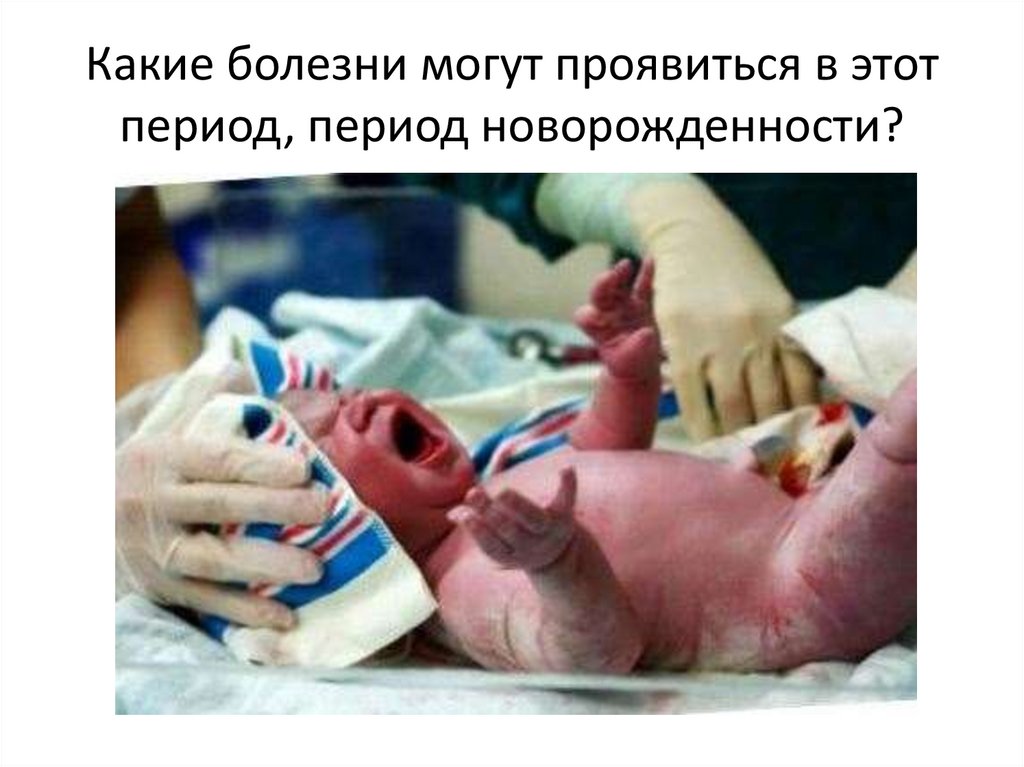 Какие болезни могут проявиться в этот период, период новорожденности?