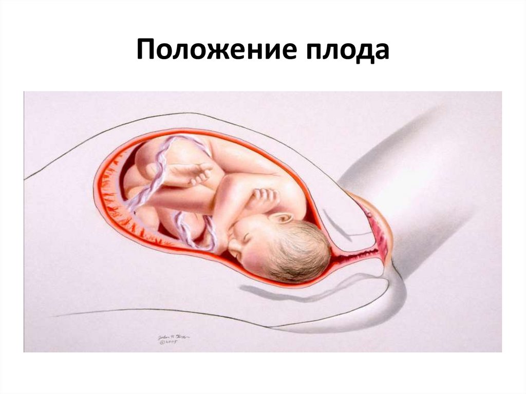 Положение плода