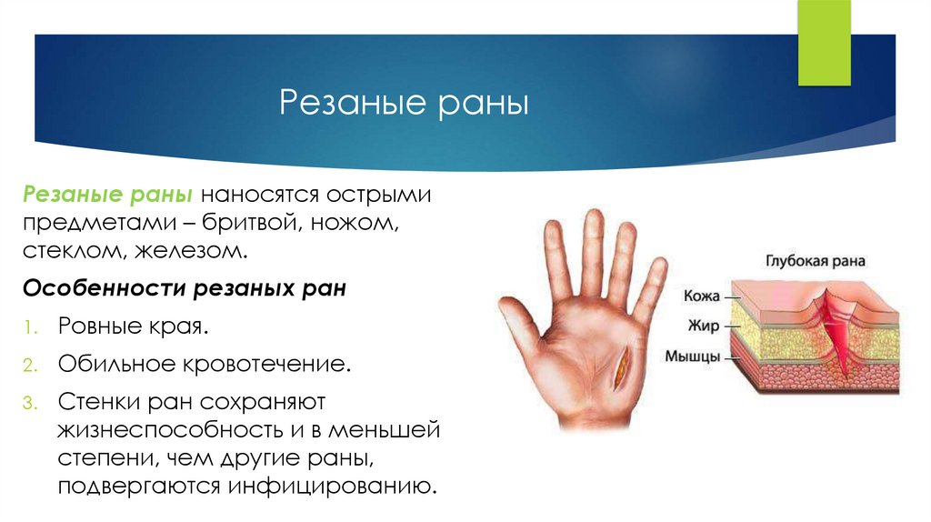 Резаные раны