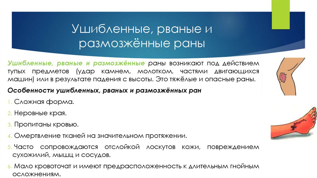 Ушибленные, рваные и размозжённые раны