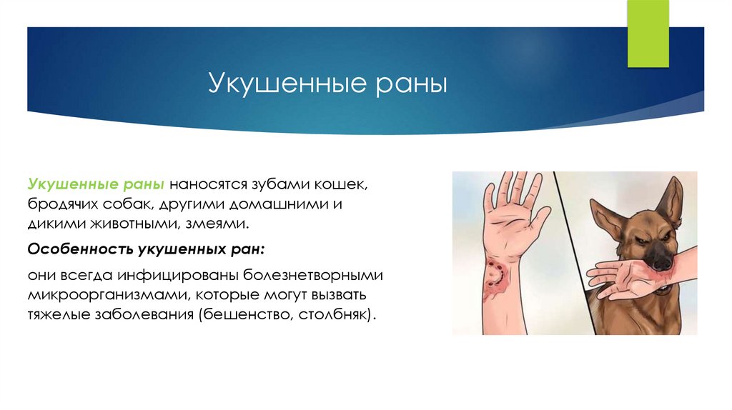 Укушенные раны