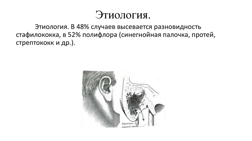 Этиология.