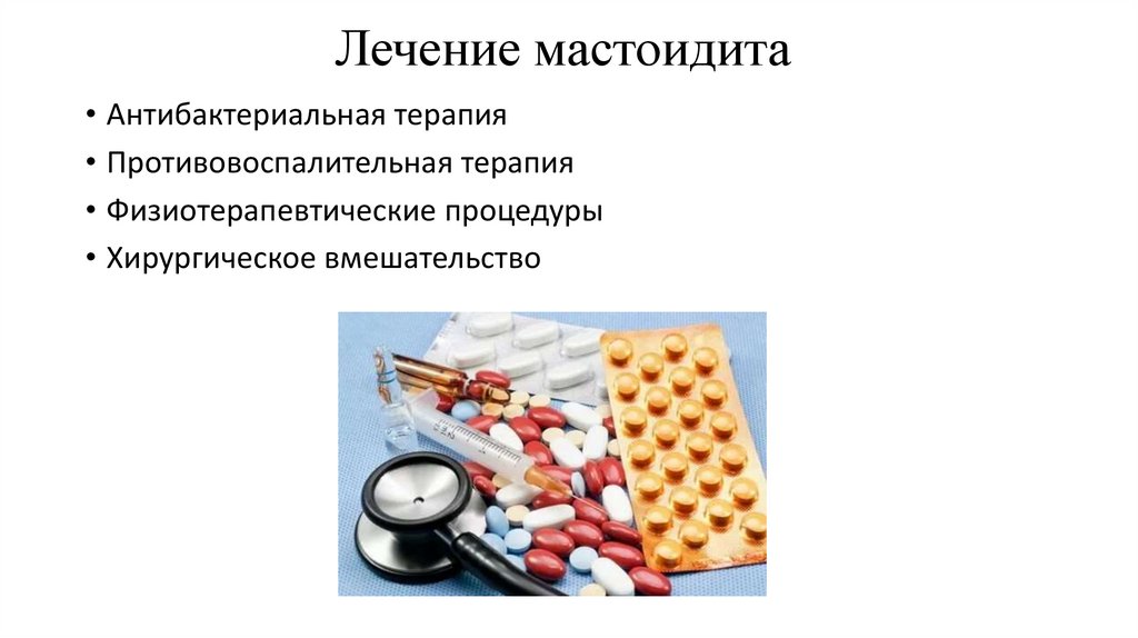 Лечение мастоидита