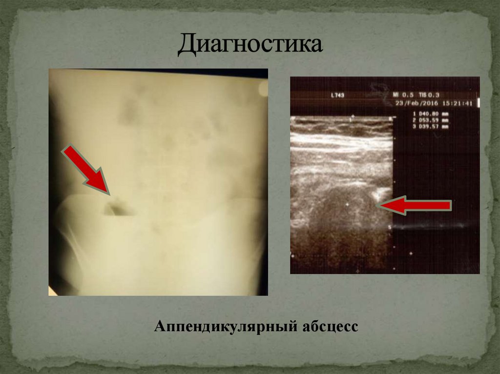 Диагностика