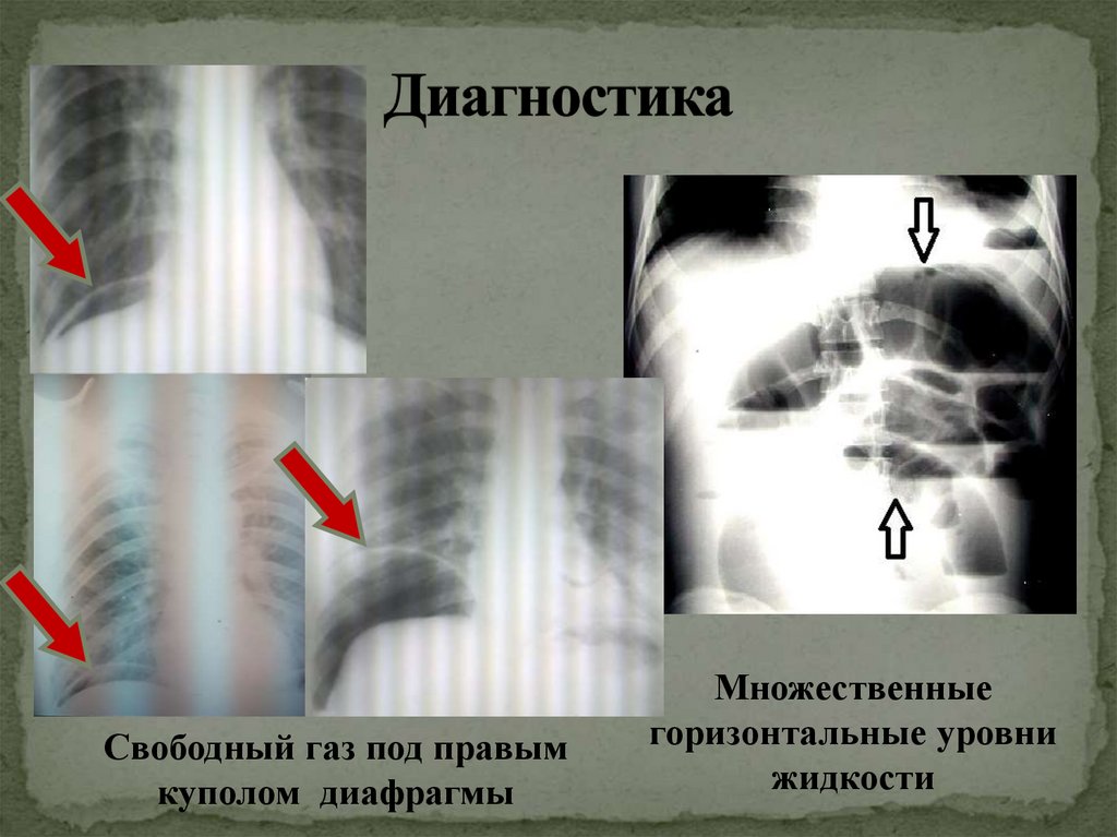 Диагностика