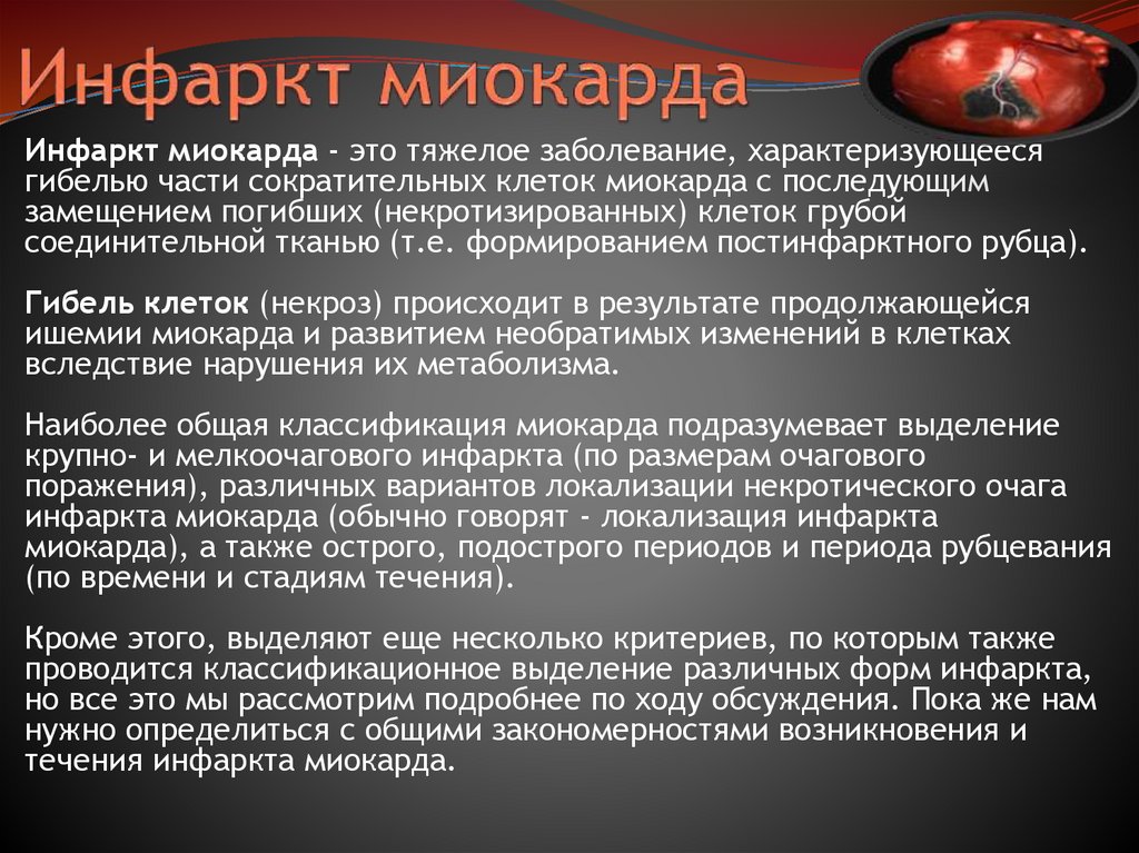 Инфаркт миокарда