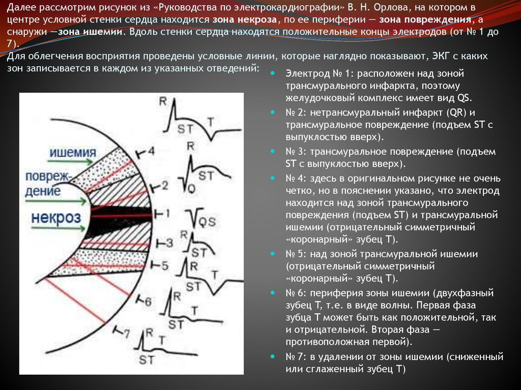 Далее рассмотрим рисунок из «Руководства по электрокардиографии» В. Н. Орлова, на котором в центре условной стенки сердца