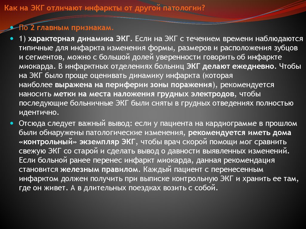 Как на ЭКГ отличают инфаркты от другой патологии?