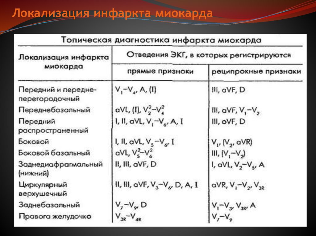 Локализация инфаркта миокарда