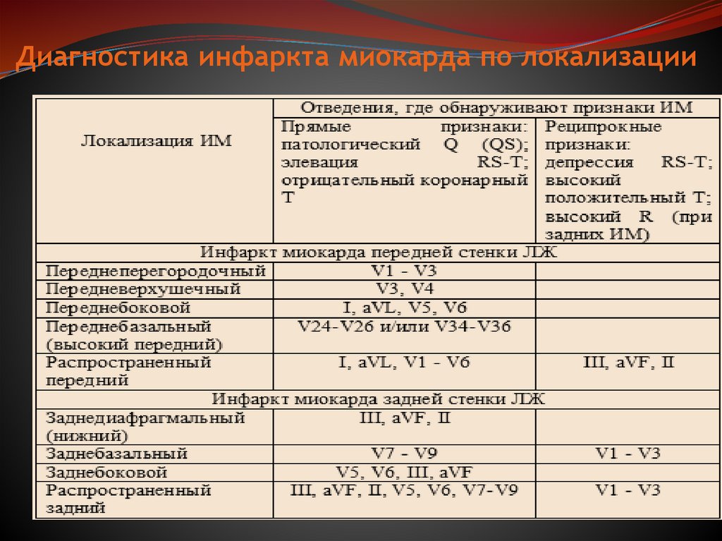 Диагностика инфаркта миокарда по локализации