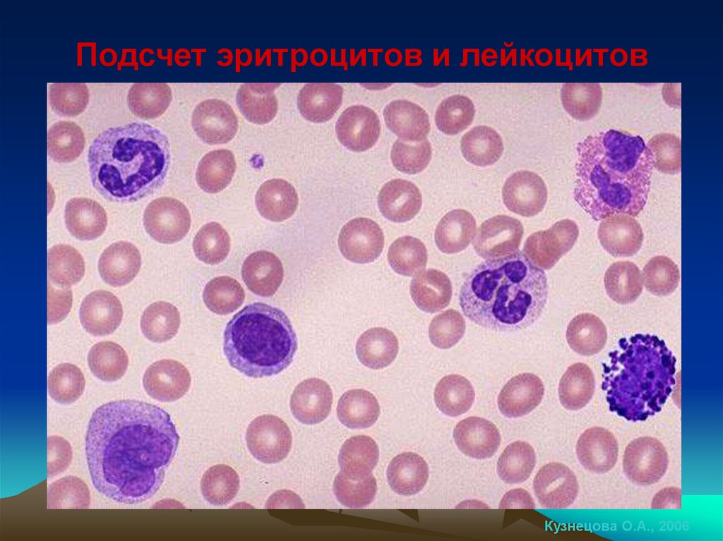 Подсчет эритроцитов и лейкоцитов